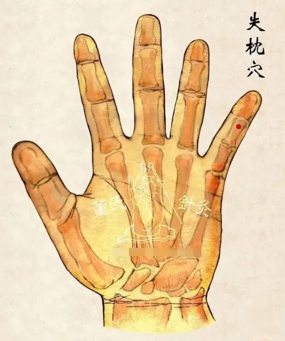 董氏奇穴 | 颈肩疼痛特效穴