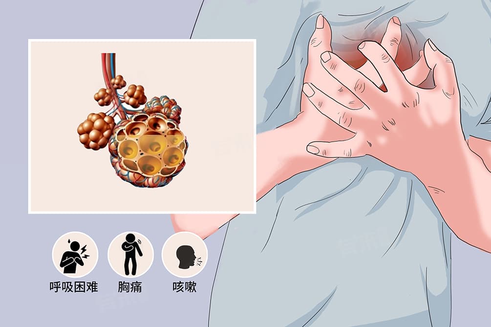 肺穿孔能治好吗？