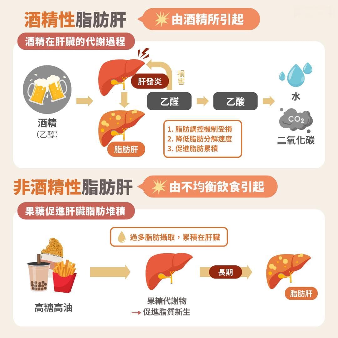 啤酒肚是脂肪肝前兆？医生解析脂肪肝成因与预防
