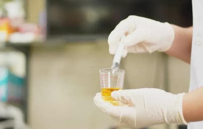 尿液很黄、总有泡沫？提醒：排尿时若有4个变化，可能是大病来袭