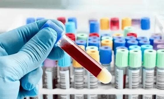 5个复查重点！骨髓增殖性肿瘤勿忘随访监测