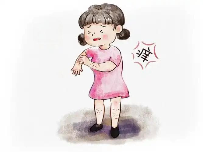 皮炎：识别、治疗与预防全指南