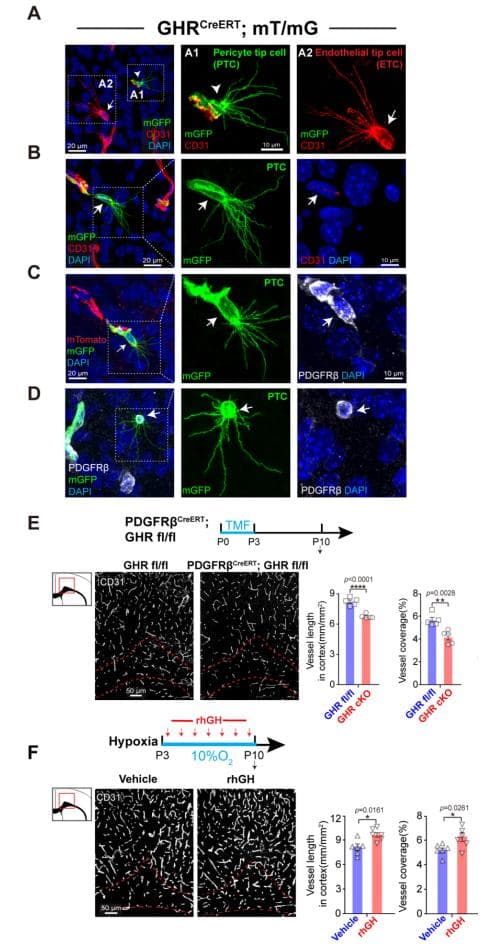 Neuron：陆军军医大学梅峰教授团队发现生长激素调节脑白质发育的新机制