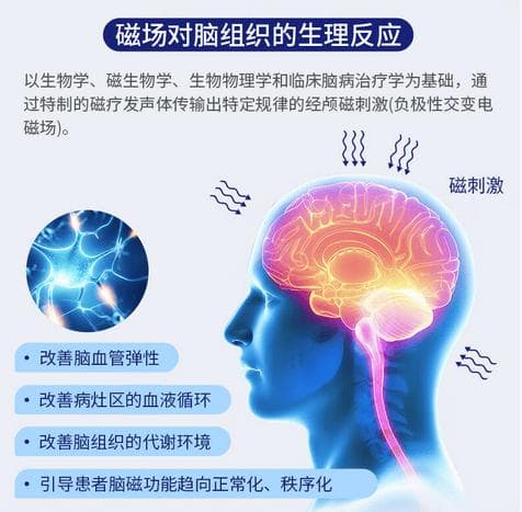 关于经颅磁刺激(TMS)，你想了解的这些问题
