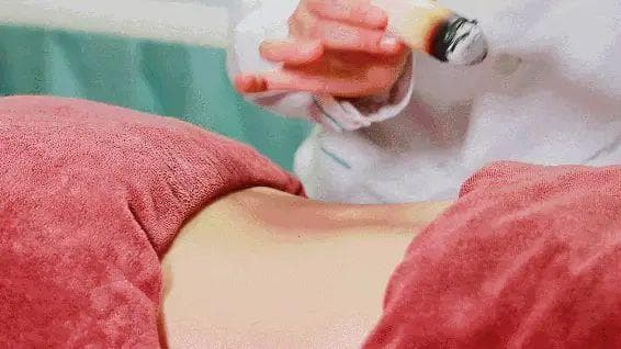 艾灸减肥的方法-单纯性肥胖减肥取穴