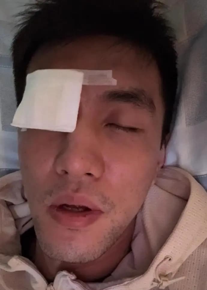 至少损失800万！谁该为郭艾伦眼部受伤负责？职业生涯恐受影响