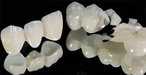 二氧化锆和全瓷牙哪个好？两者区别明显：二氧化锆强度高/全瓷牙生物相容性好！