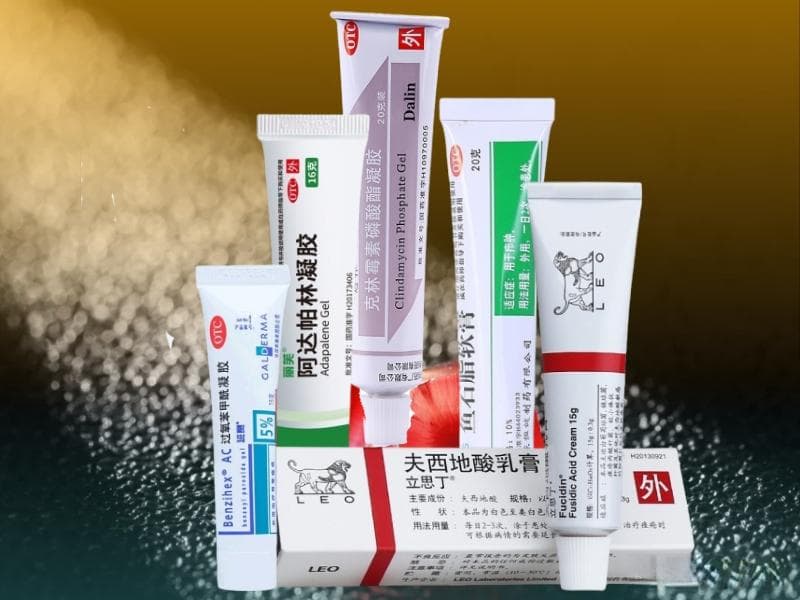 平价祛痘膏合集：功效、正确用法全解析
