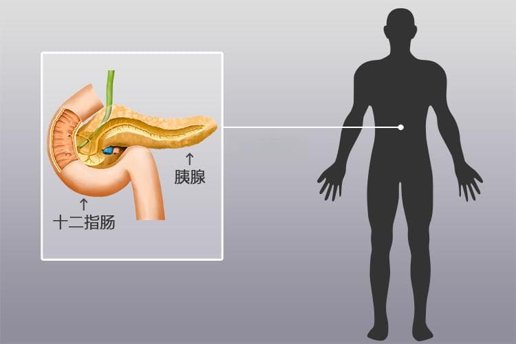 胰腺炎可以用6542吗