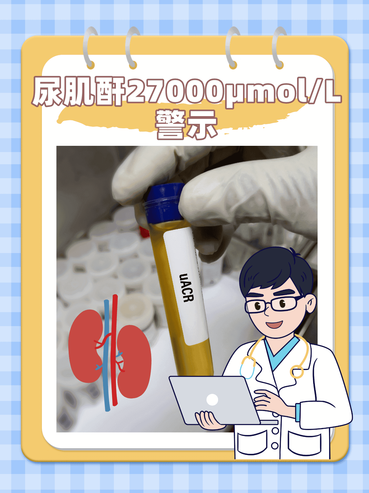 尿肌酐27000μmol/L警示：肾脏健康的重要信号