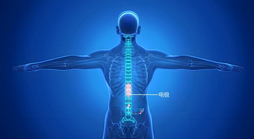 针灸、电刺激等理疗方法在脊髓神经损伤康复中的作用是什么？