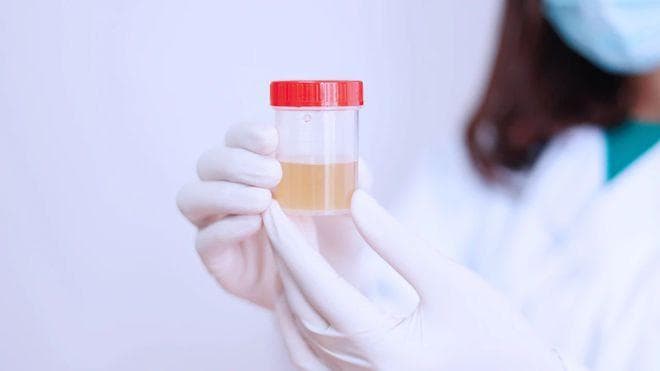 健康与否，排尿可知！排尿时出现4个信号，别掉以轻心，尽早检查