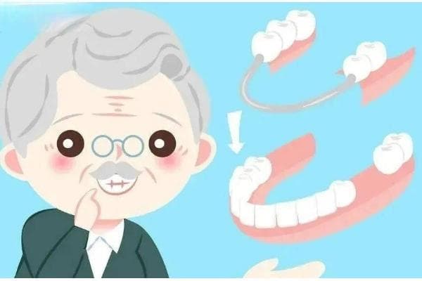 假牙日常应该怎么护理？盘点伤害假牙的三大习惯以及假牙护理指南