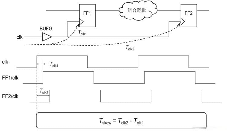 优化时钟网络之时钟偏移