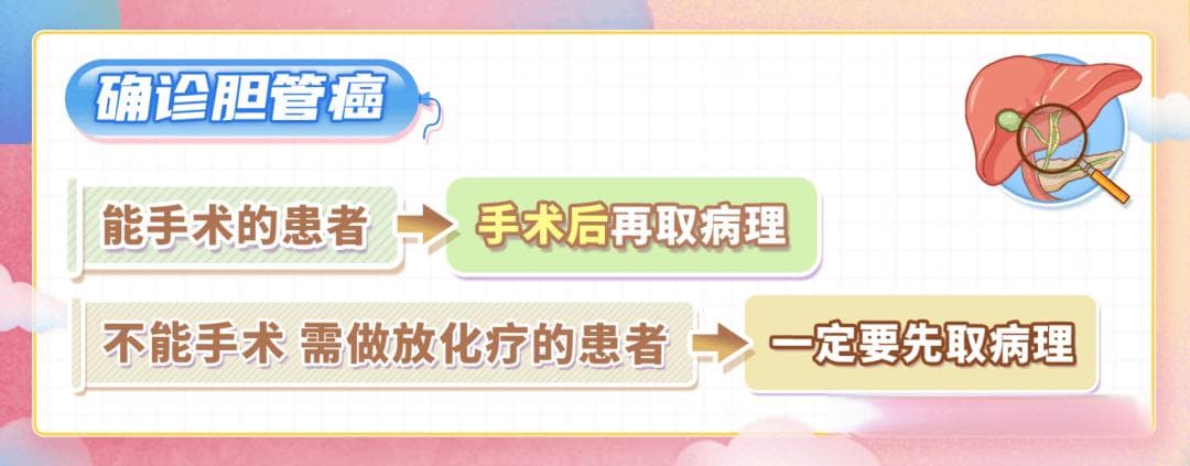 怀疑胆管癌需要做什么检查？