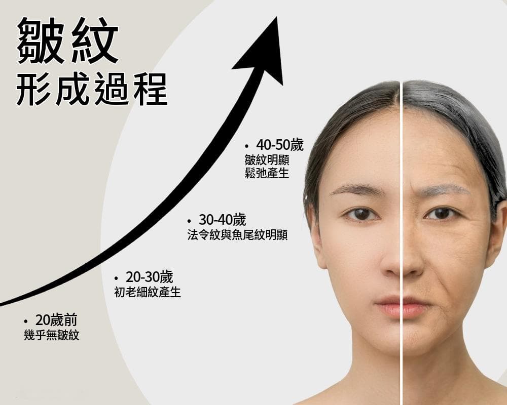 挥别「脸部皱纹」藏住岁月的痕迹：了解皱纹种类、形成原因与破解方式