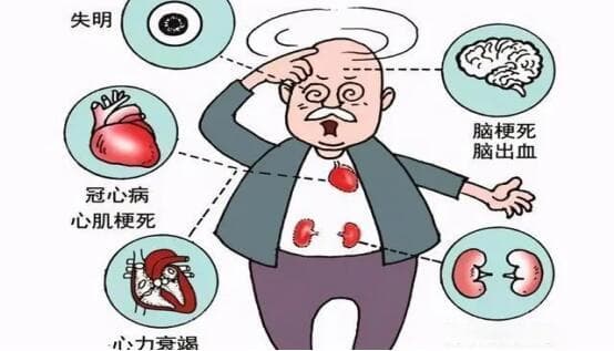 高血压到底能不能献血？