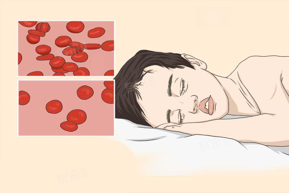 贫血会出现什么症状