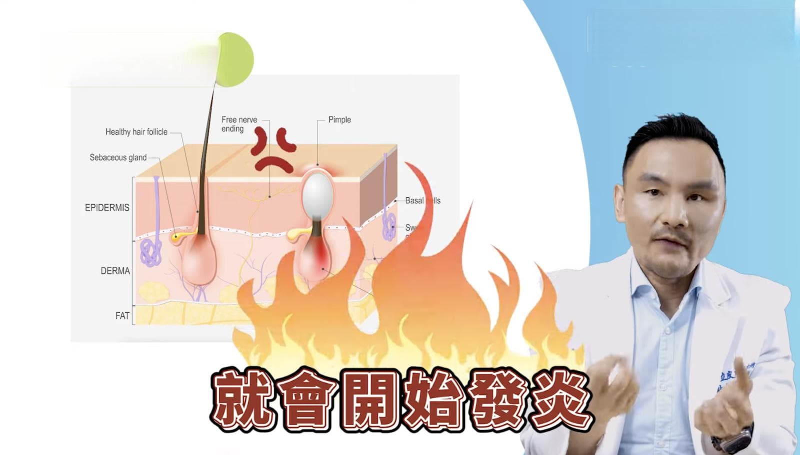 痘痘一直好不了！竟是自己造成的？