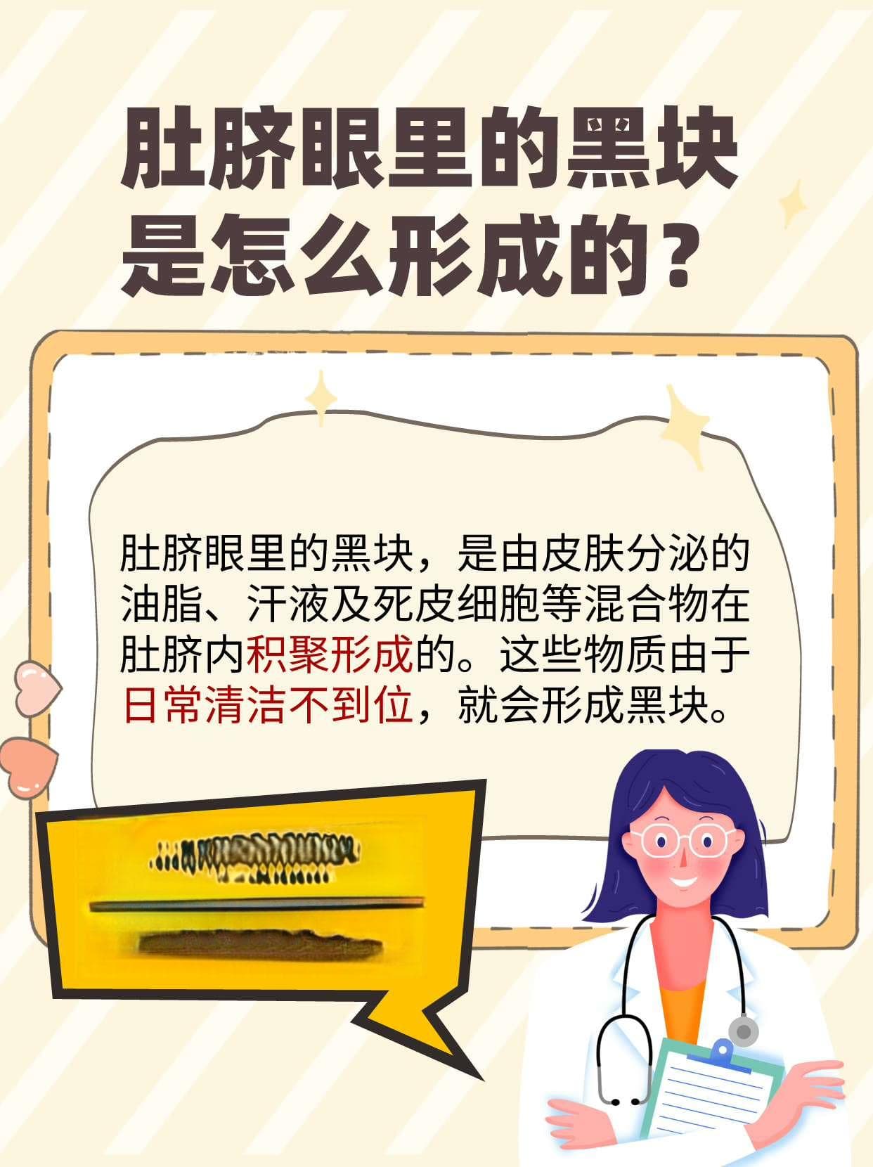 扣肚脐眼里的黑块，危险吗？一文告诉你真相