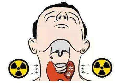脖颈上的黑蝴蝶——甲状腺肿瘤