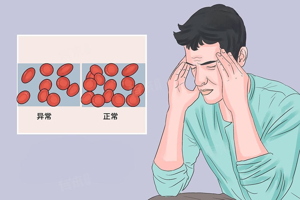 一文读懂小细胞贫血：从病因到治疗方案