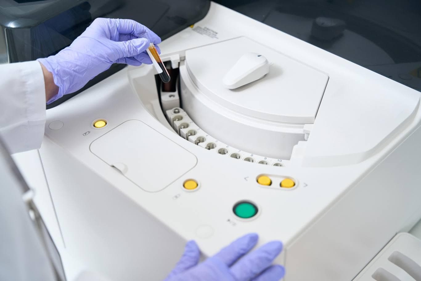 一旦升高就是患癌？别紧张，这篇文章教你科学认识肿瘤标志物