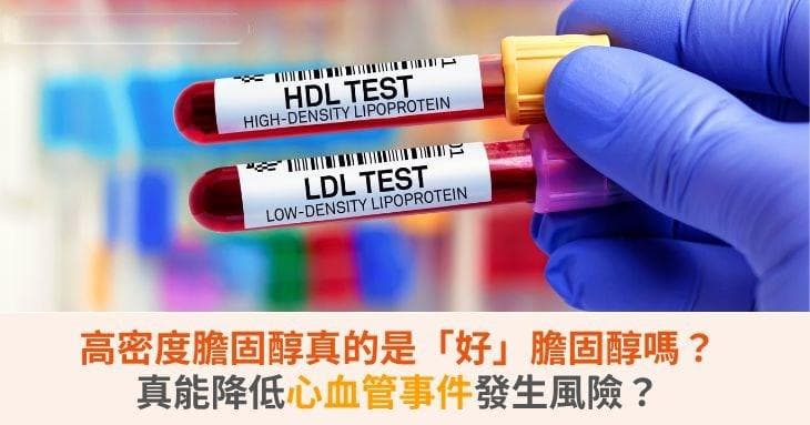 高密度膽固醇真的是「好」膽固醇嗎？真能降低心血管事件發生風險？