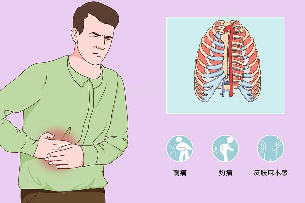 肋间神经痛怎么办