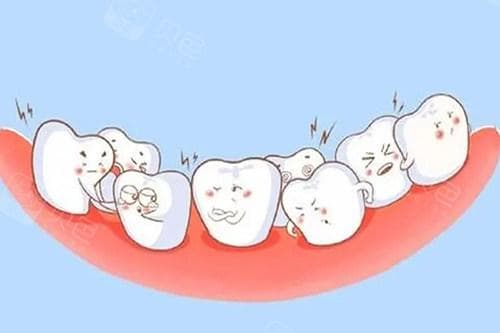 智齿是否需要拔除？附清洁技巧及拔牙适应症全解析