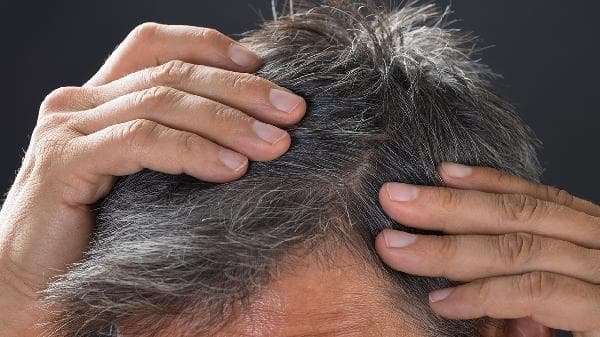 男生如何保养头发不秃头