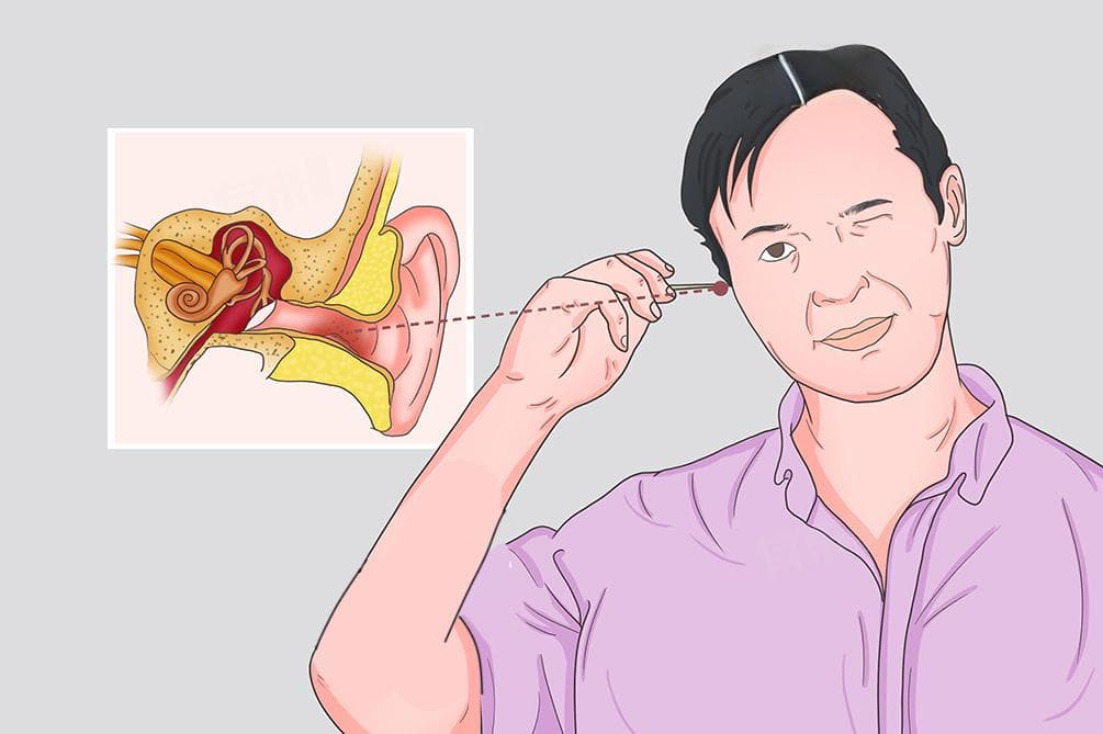 为什么掏耳朵的时候会咳嗽