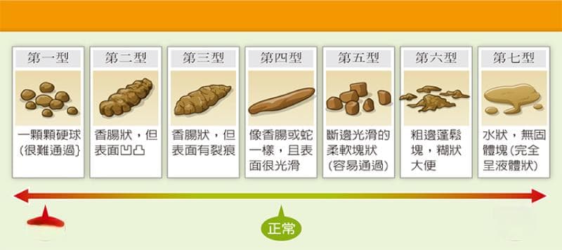 儿童便秘怎么办？从诊断到治疗的全面指南