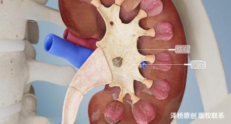 这7种蔬菜，必须焯水后再吃