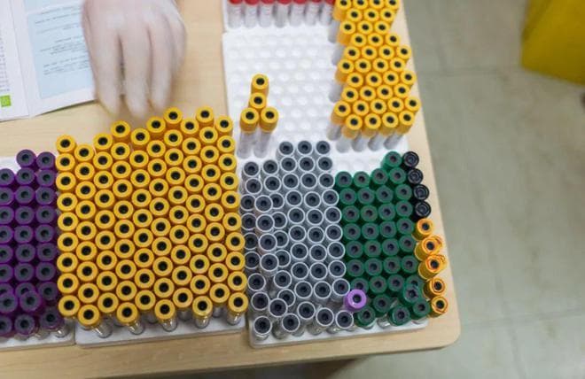 体检发现肿瘤标志物升高，什么情况下需要特别关注？