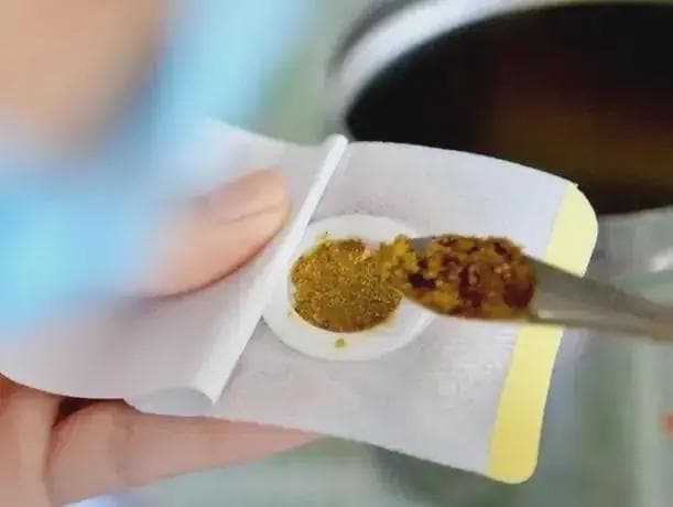 中药穴位贴敷疗法：原理、应用与注意事项全解析