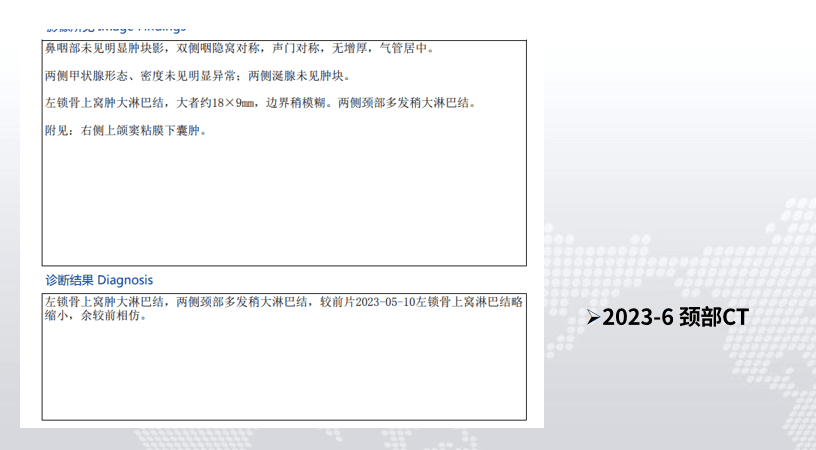 一例胆囊癌诊疗过程的分析与思考