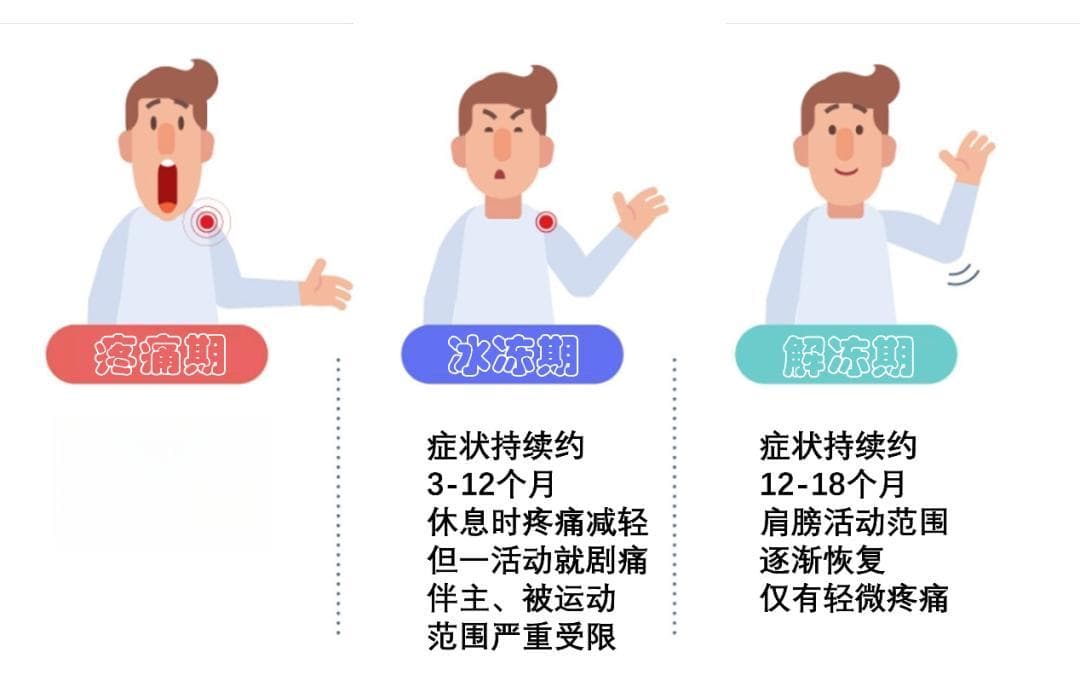 肩膀“冻住了”，如何快速“解冻”？