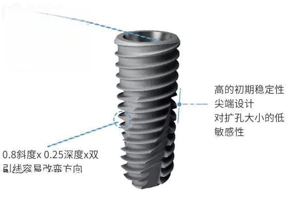 不同价位的种植体区别在哪里？不同的档次植体选择攻略
