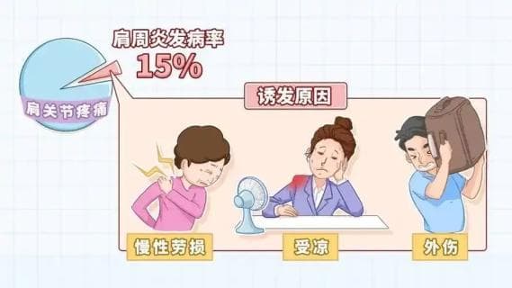 砀山中医专家详解肩周炎：症状、成因、治疗与预防全攻略