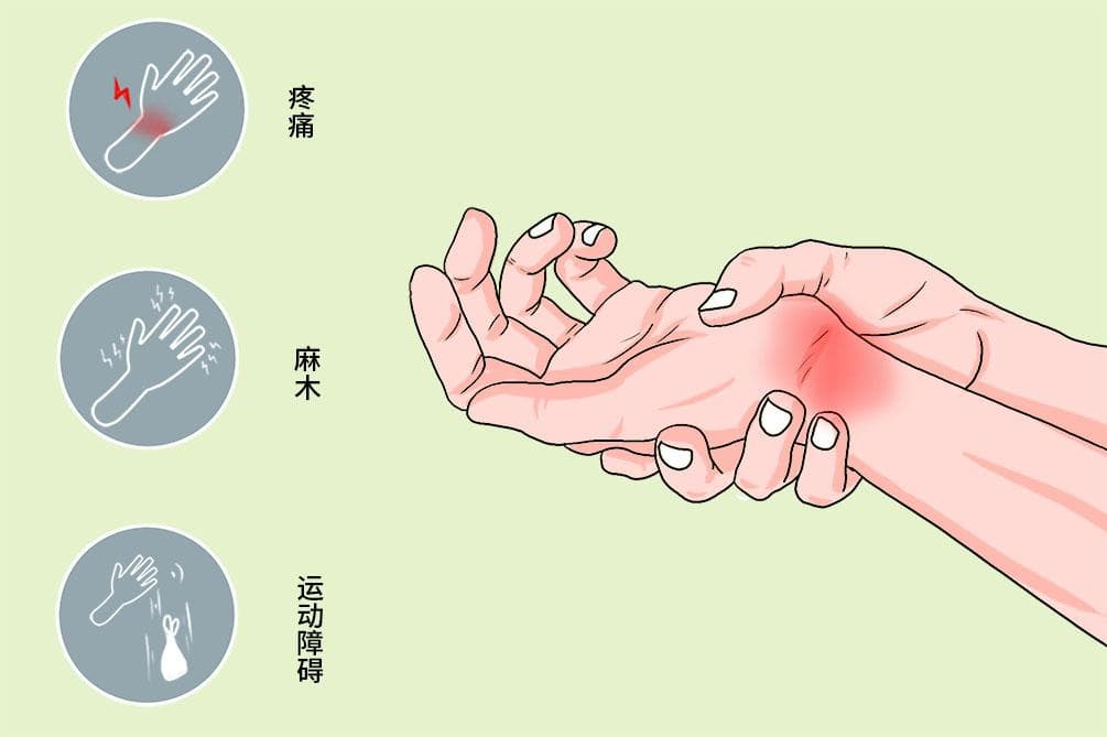 腕管综合征的症状和治疗方法