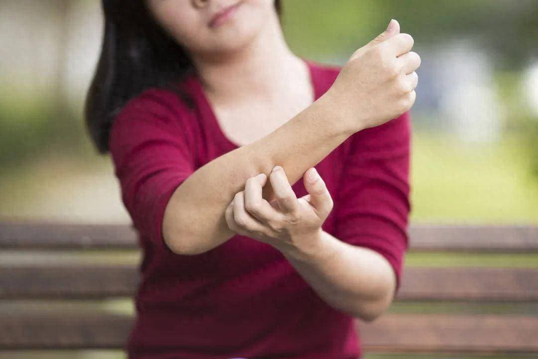 一运动皮肤就发痒，是脂肪在燃烧吗？其实这可能是一种病！
