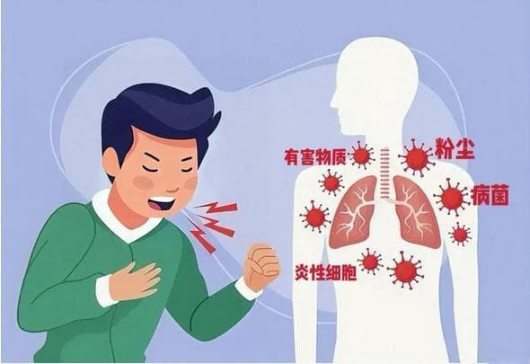 秋冬咳嗽防治指南：北京医院专家支招