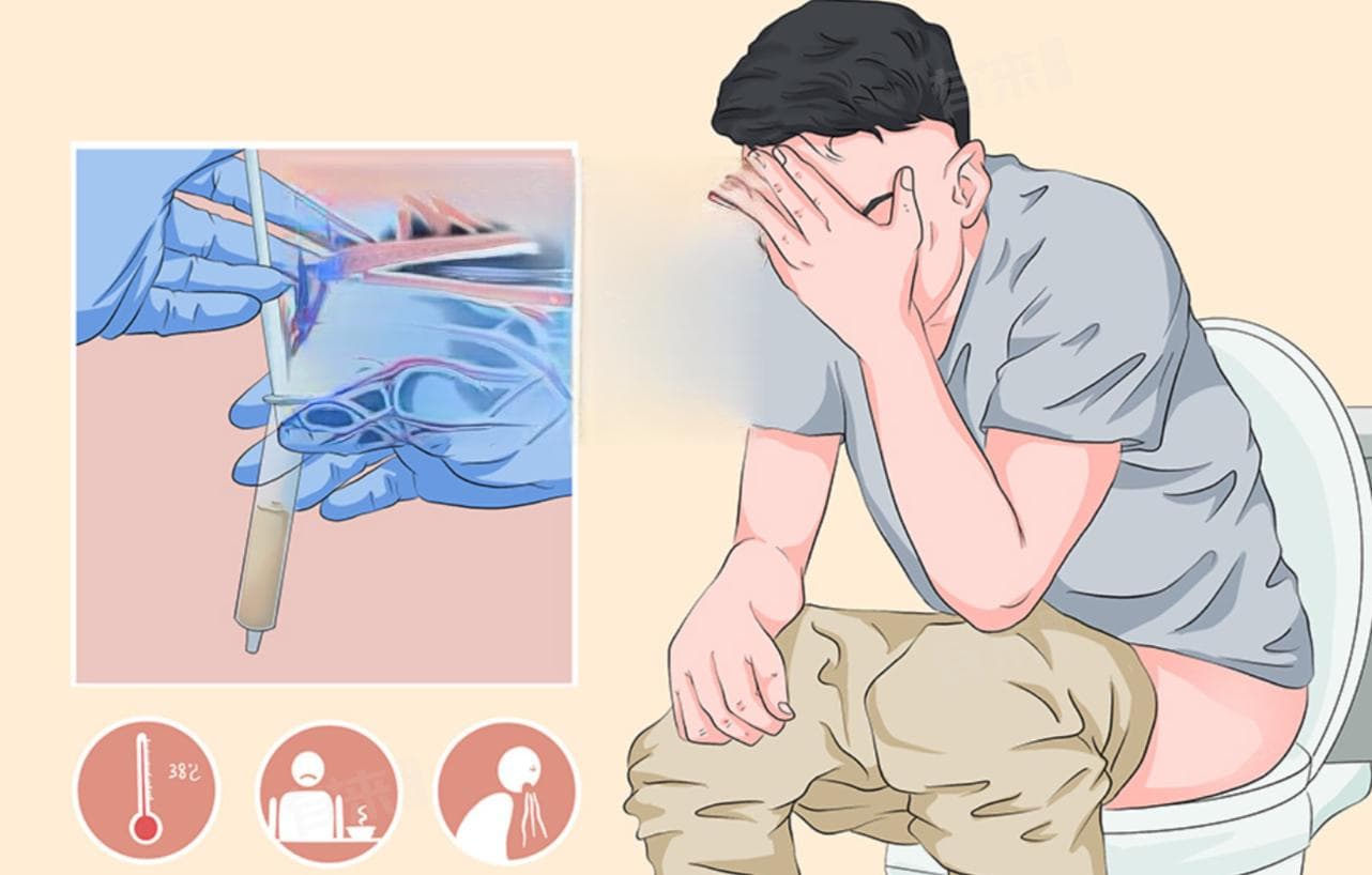尿液是茶色的是怎么回事