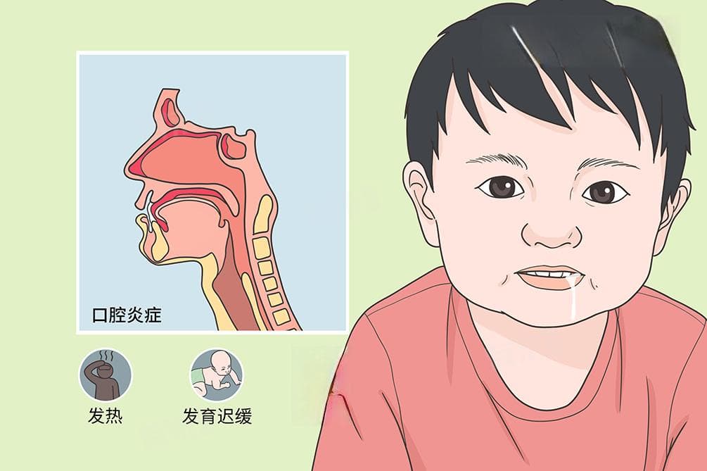 晚上睡觉流口水是什么原因造成的