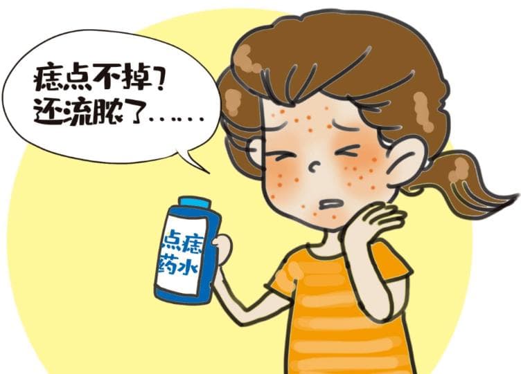 药水点痣，靠谱吗？