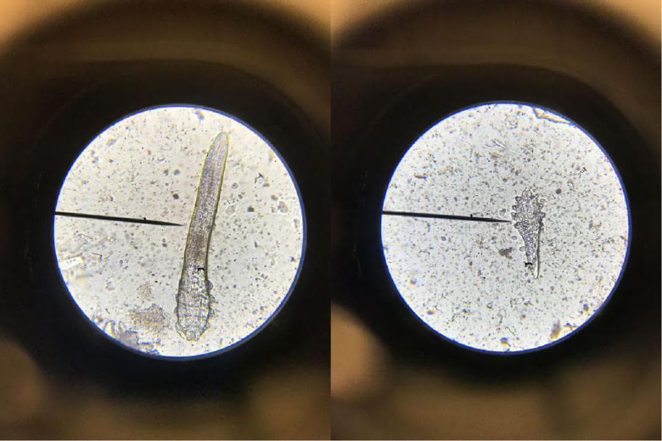 你所不知道的螨虫