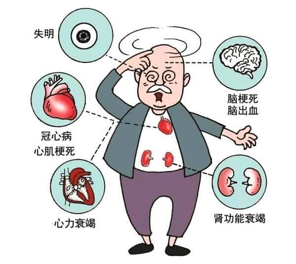 如何早期识别高血压的蛛丝马迹？