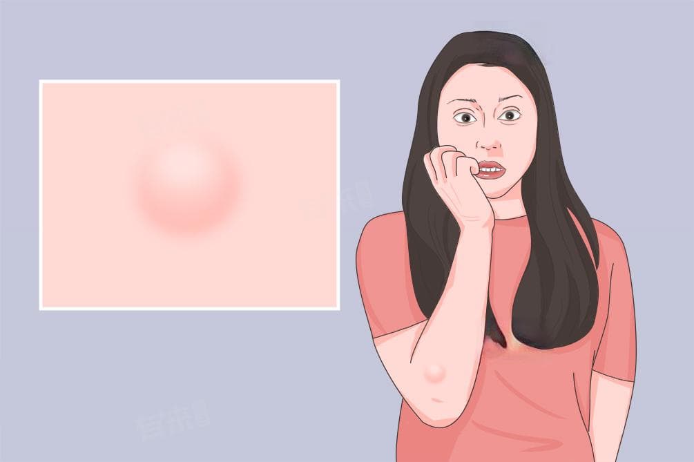 囊肿要怎么治疗？必须动手术吗？