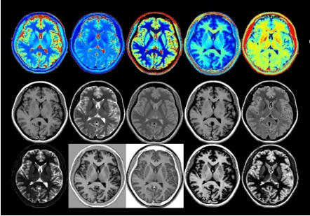 合成MRI：提升脑部成像技术的效率与精确性